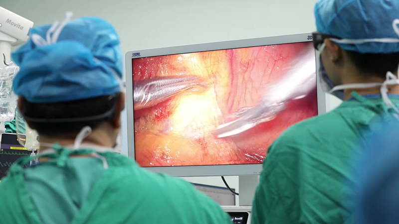 腹腔鏡手術(shù) 腹腔鏡手術(shù)